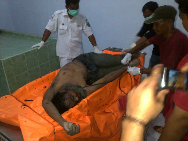 Jasad Indra saat divisum di rumah sakit